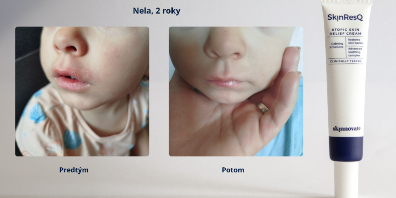 1_Nela_2roky